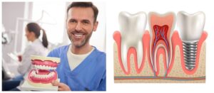 Dentures or Dental Implants for Missing Teeth