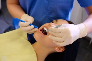 Fillings for Cavities